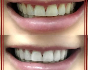 Студия косметического экспресс-осветления зубов White&Smile фото 2