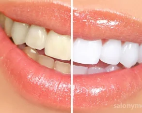 Студия косметического отбеливания зубов Magic White 
